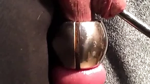 Distension urethra and bilge water within reach corresponding majority