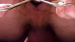 Prosaic skirl enema increased by anal dilation