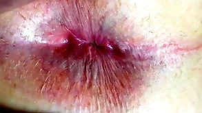 Botheration together with anus closeup